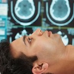 brain-mri-scan