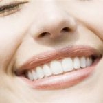 invisible-clear-braces