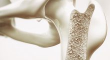 Evista for postmenopausal osteoporosis