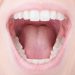 Dry Mouth? Check Out These Facts and Tips